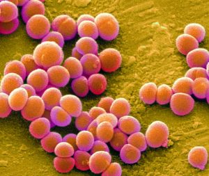 MRSA bacteria, coloured scanning electronmicrograph (SEM). Methicillin-resistantandlt;emandgt;Staphylococcus aureusandlt;/emandgt; (MRSA) is aGram-positive, round (coccus) bacterium. It isresistant to many commonly prescribed antibiotics.andlt;emandgt;S. aureusandlt;/emandgt; is carried by around 30% of thepopulation without causing any symptoms. However,in vulnerable people, such as those that haverecently had surgery, it can cause woundinfections, pneumonia and blood poisoning.Magnification: x4800 when printed at 10centimetres wide.