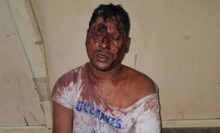 সুনামগঞ্জে ইউপি সদস্যকে পেটালো ঠিকাদারের লোকজন