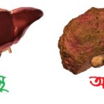 সুস্থ লিভার